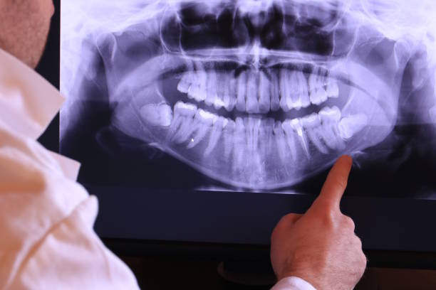 Best Emergency Gum Pain Relief  in Lasalle, IL