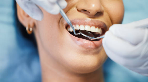 Best Urgent Tooth Repair  in Lasalle, IL