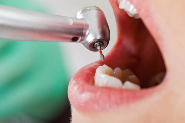 Best Cracked Tooth Emergency Dentist  in Lasalle, IL